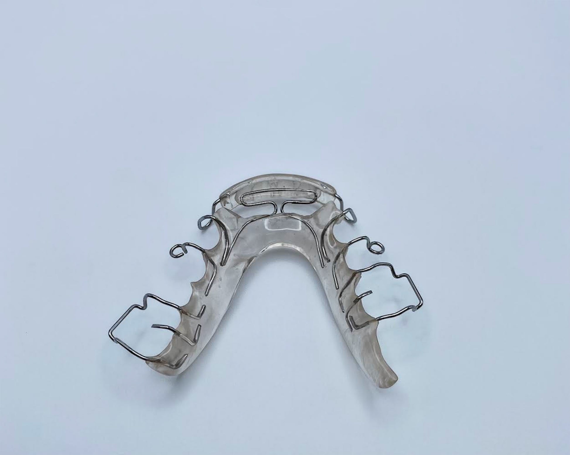 Spring Aligner โ Splintortho